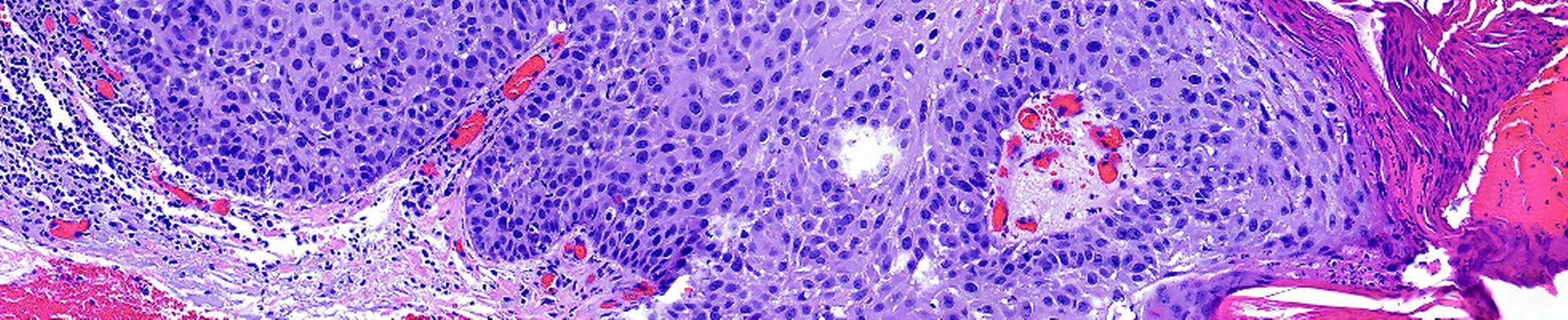 Berkeley Grad Student Death Lathe - 1b86c49bb90ef418dd3b1a2470428d2f